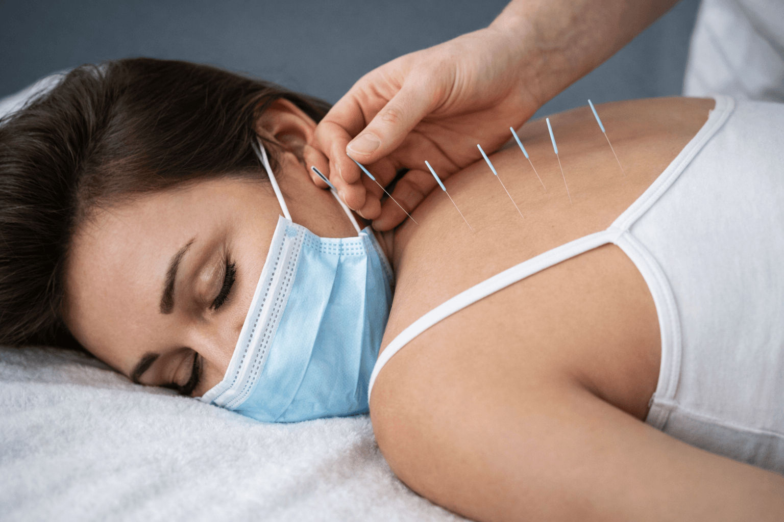 Dry Needling Therapy